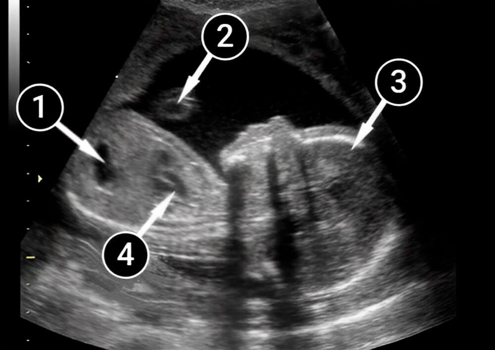 El desarrollo fetal de tu bebé llega a su primera meta