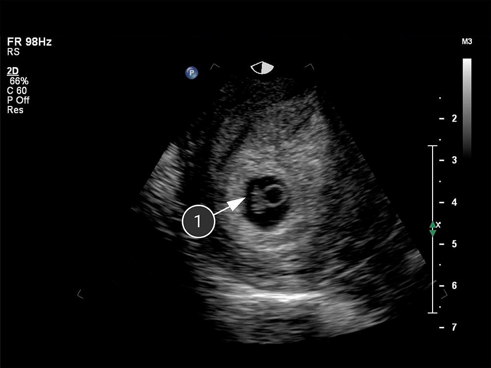 Desmitificando la concepción