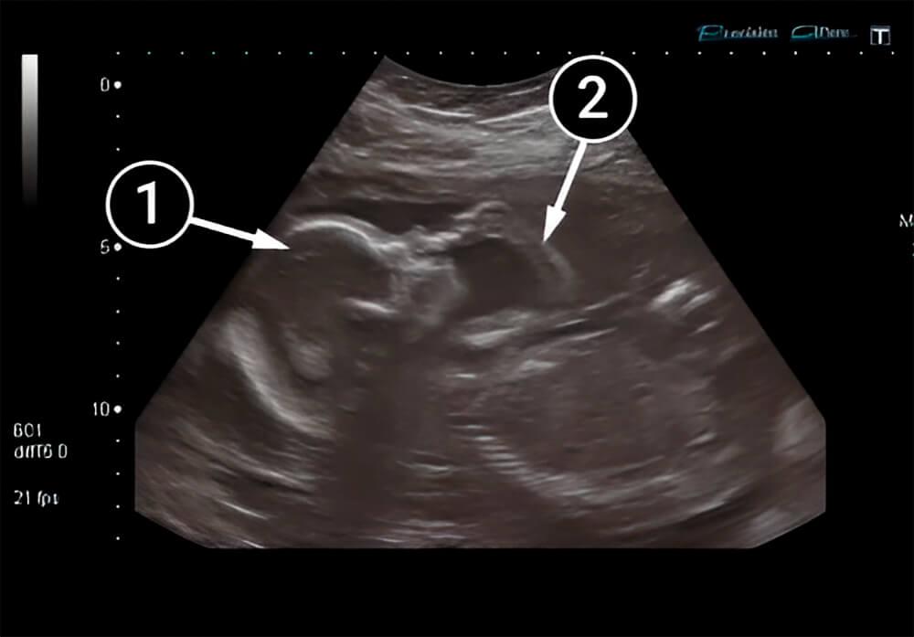 El bebé sigue creciendo