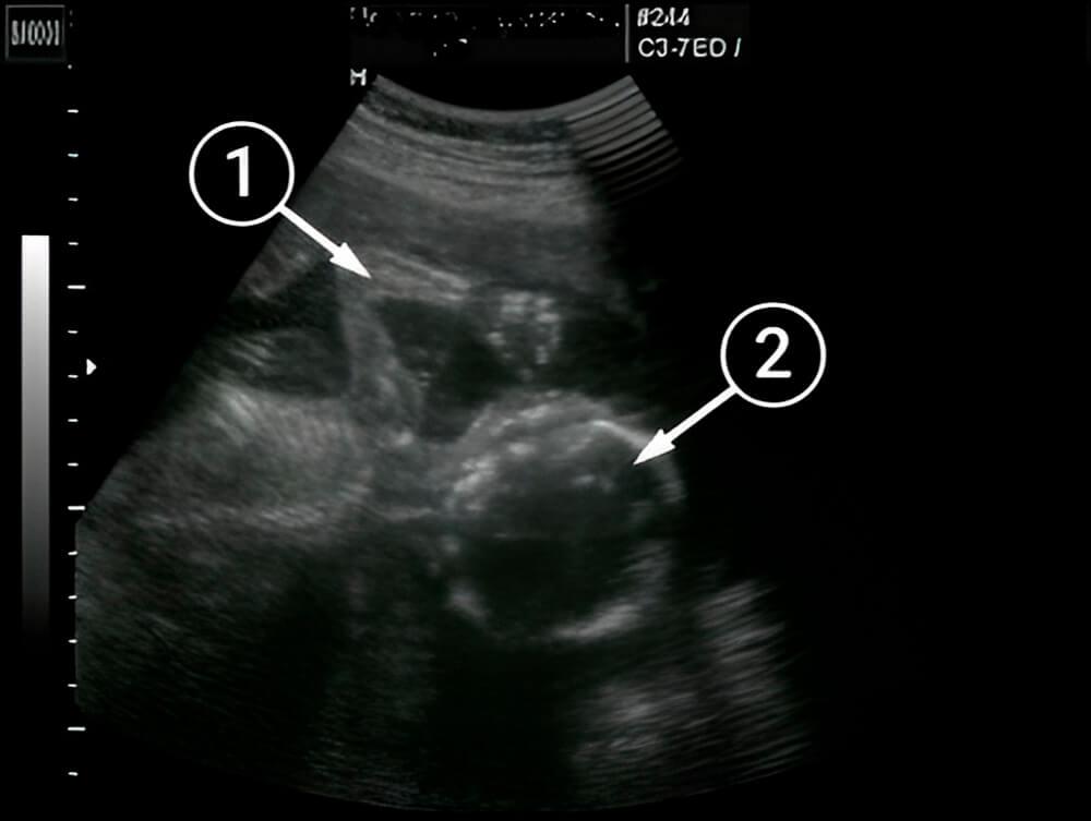 Tu bebé cada día se mueve más