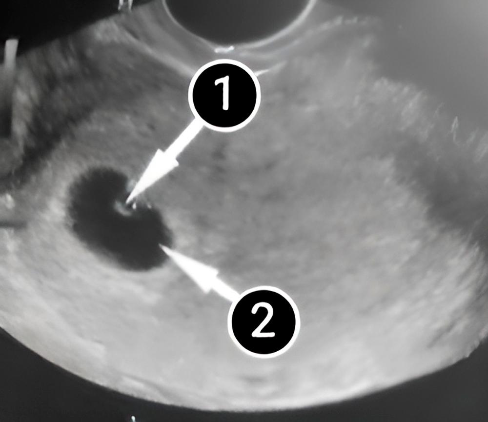 El bebé está bien protegido