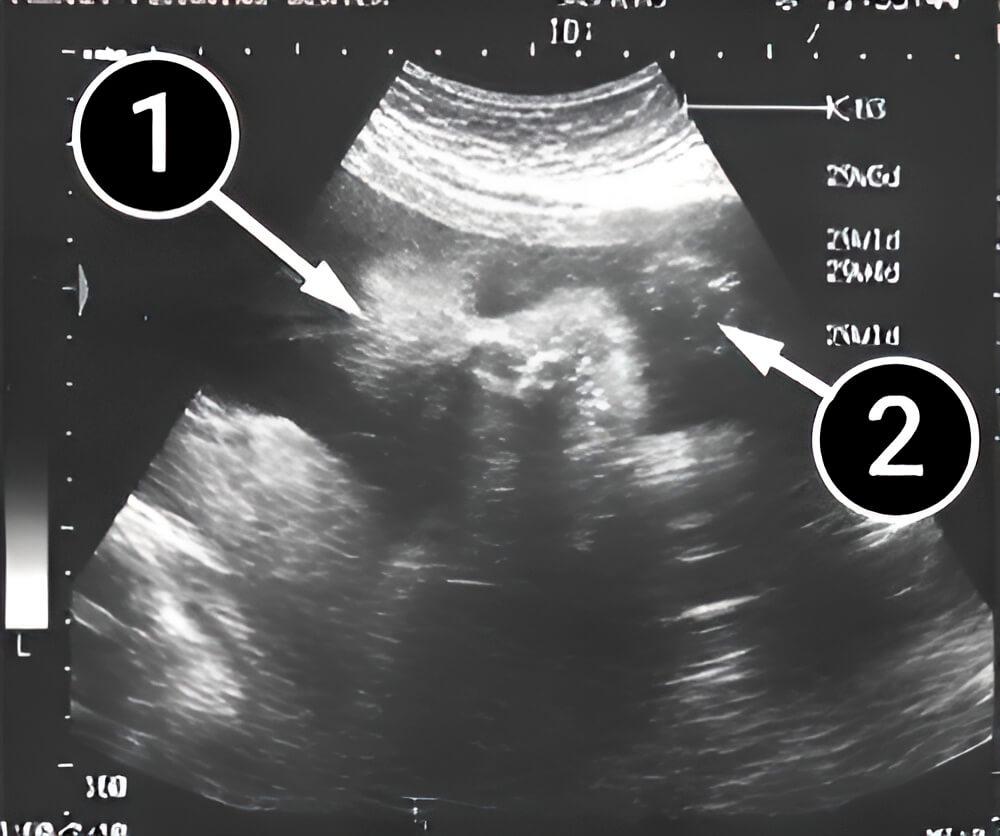 El cerebro de tu bebé se desarrolla con rapidez