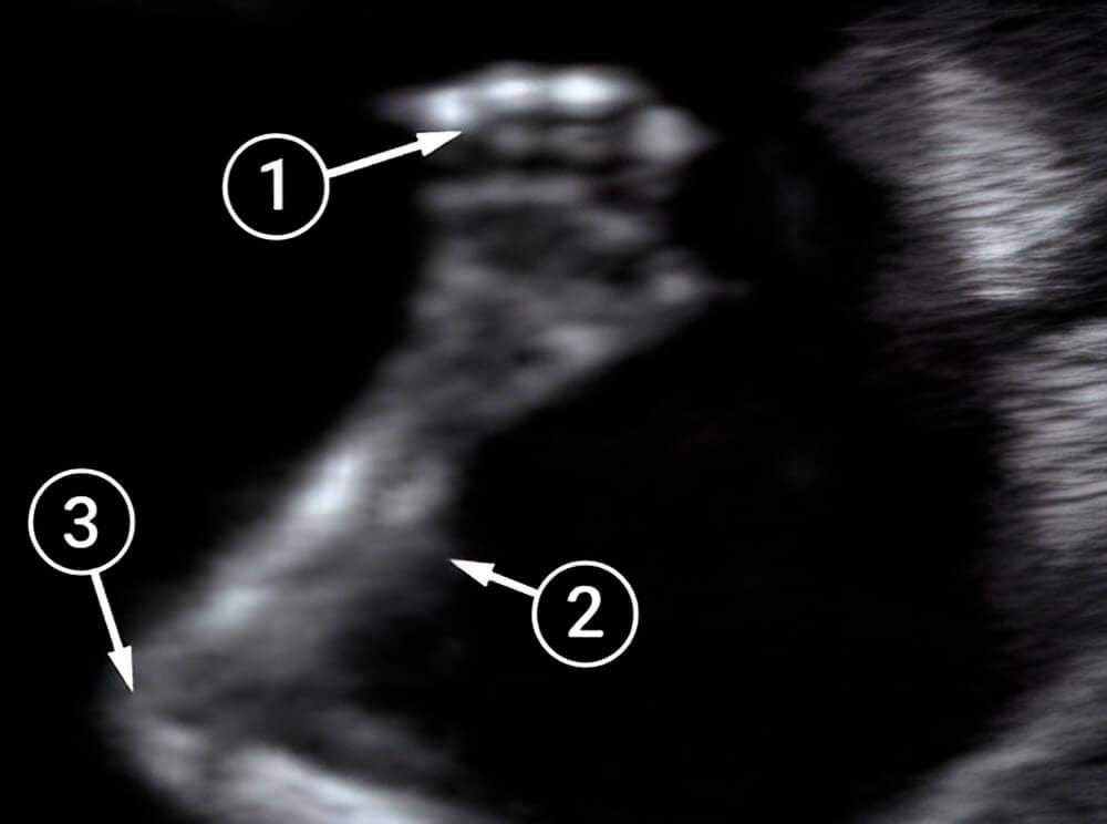 Las facciones del bebé son más distinguibles