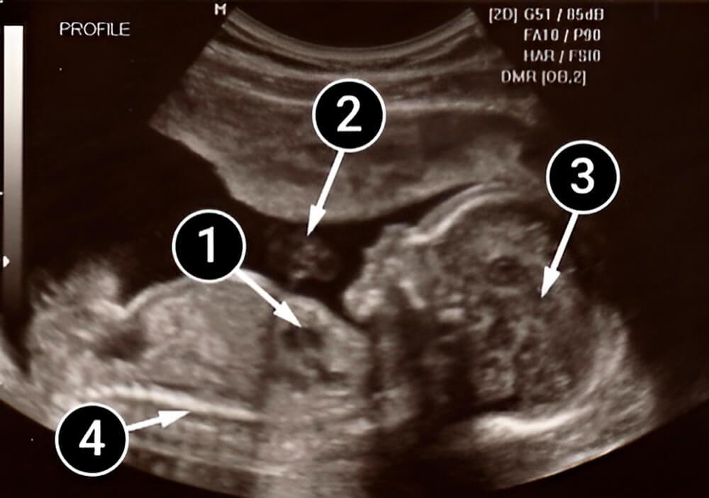 Esta semana la placenta ya está formada