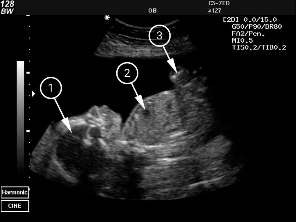 Tu bebé puede escuchar tu voz