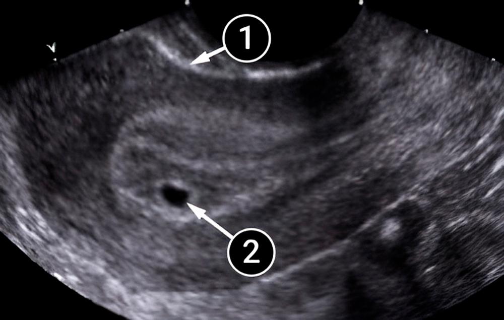 ¡El bebé está creciendo!