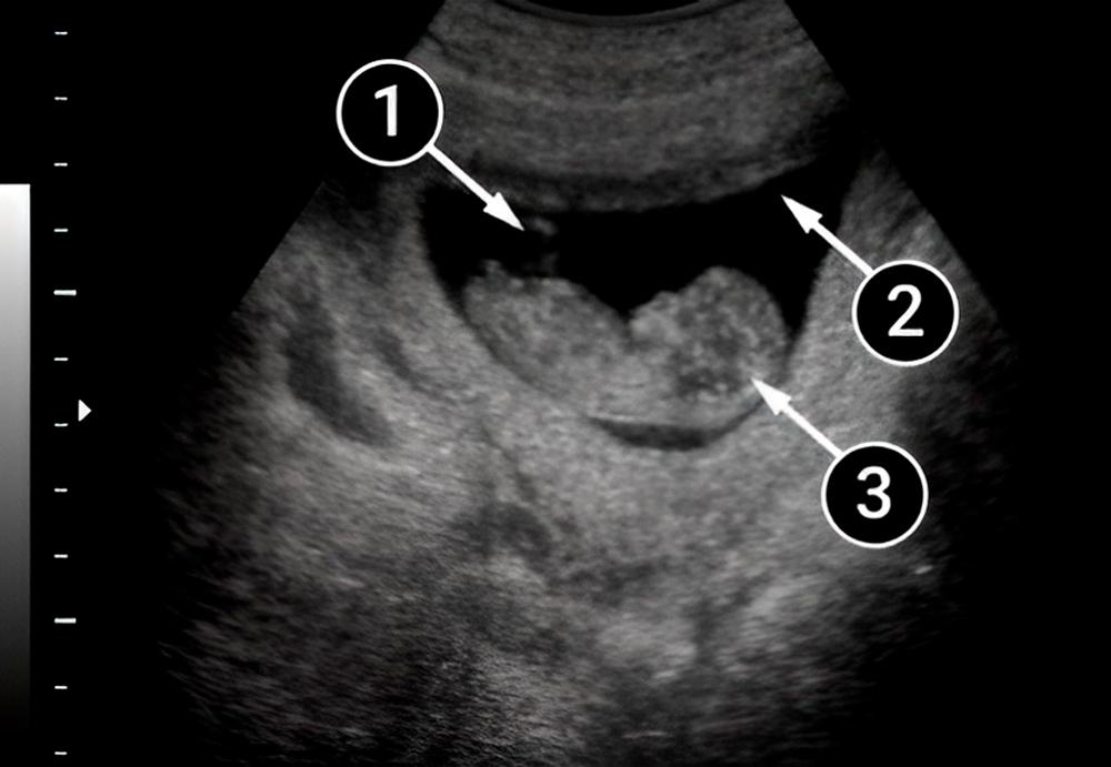 Tu bebé patea y se mueve