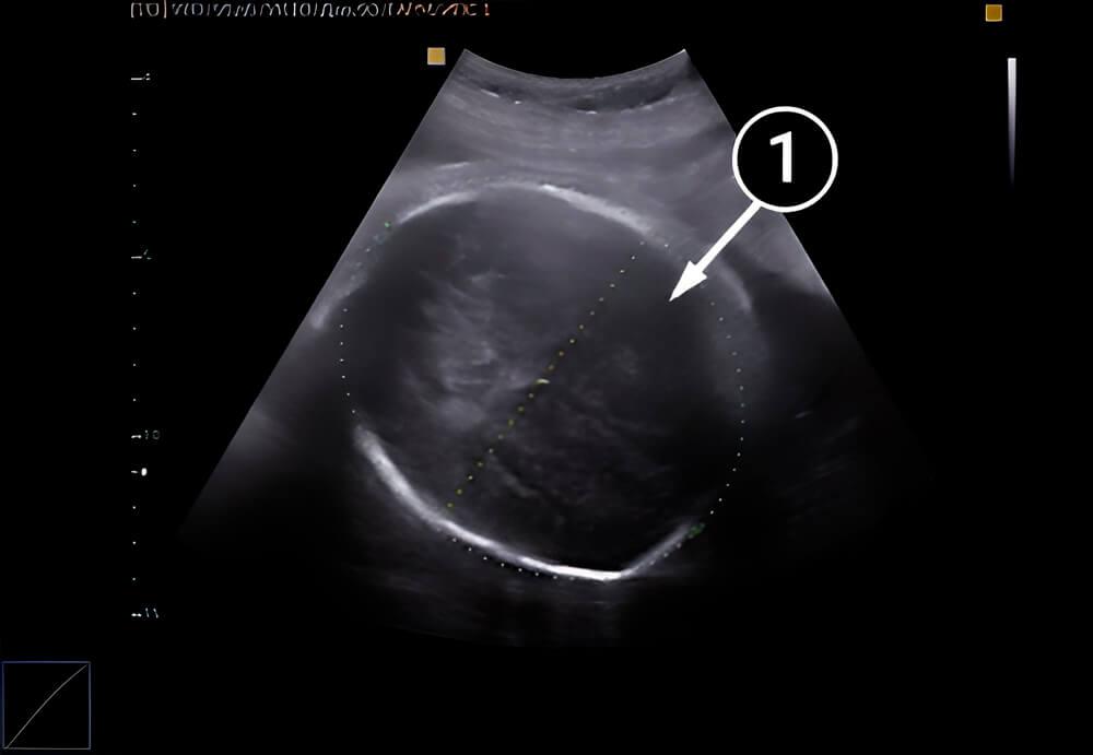 ¡Prepárate para conocer a tu bebé!