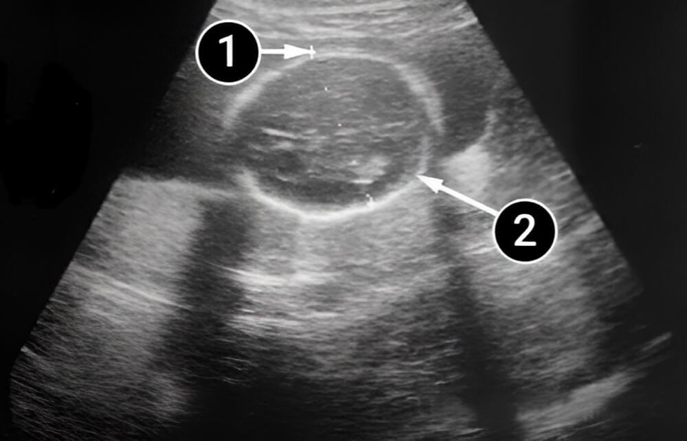 Los reflejos del bebé se vuelven más precisos