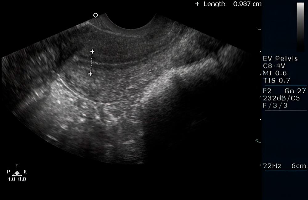 ¿Cuándo comienza el embarazo?