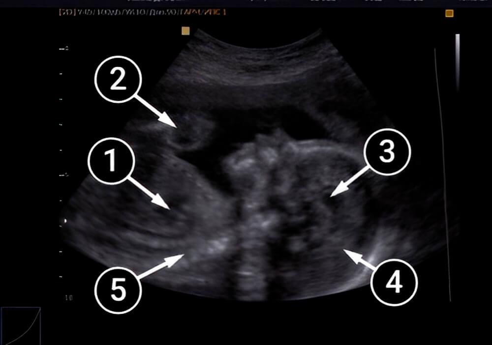 Tu bebé está ganando fuerza