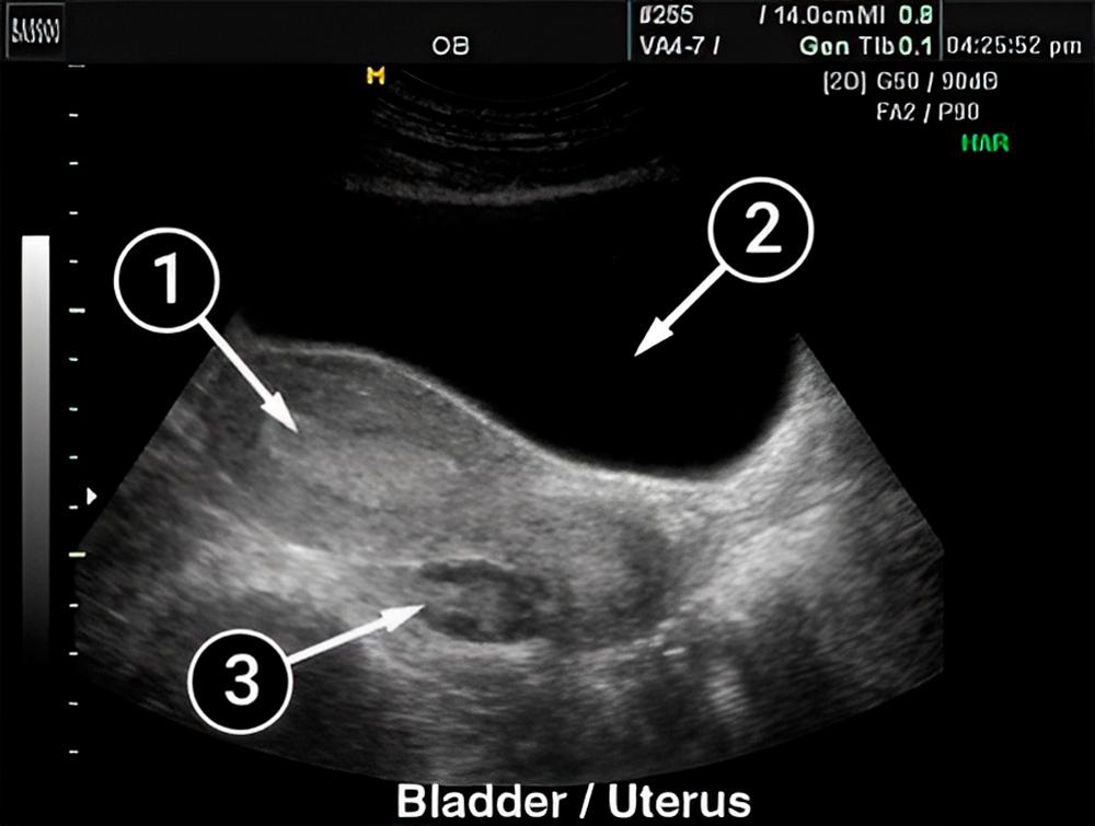 En sus marcas, listos, ¡a embarazarse!