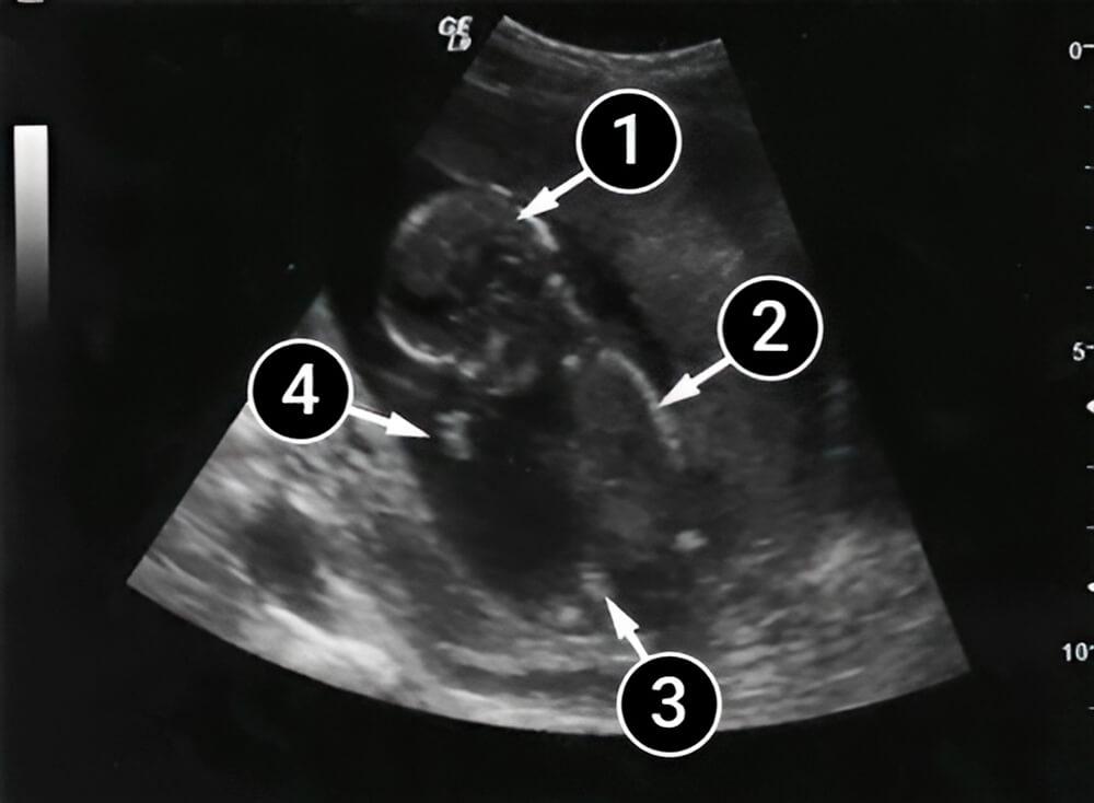 Las facciones del bebé son más distinguibles