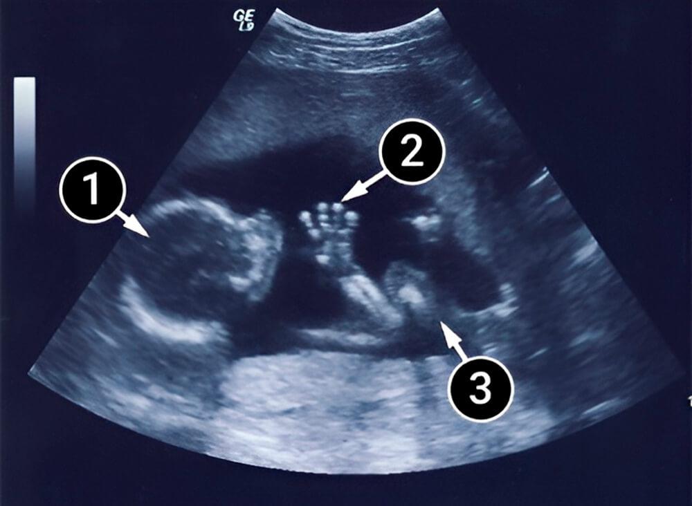 Tu bebé ya hace caritas