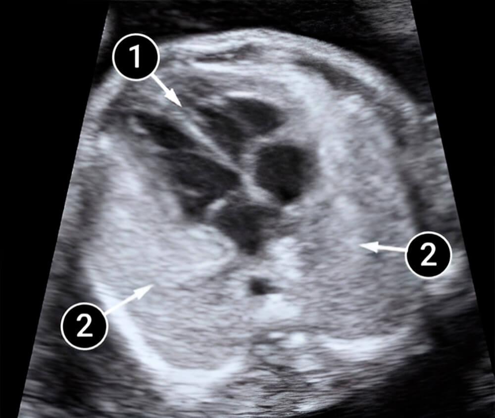 El bebé puede abrir los ojos