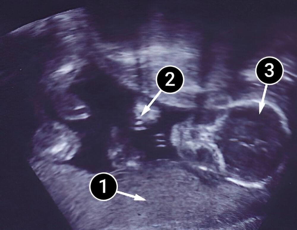 El desarrollo fetal de tu bebé llega a su primera meta