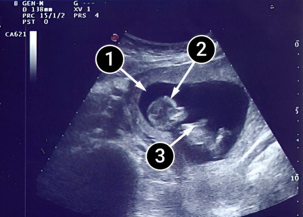 Tu bebé aprende a chuparse los dedos [1]