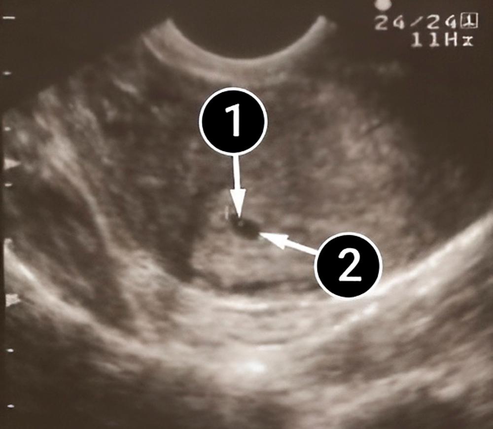 ¡El bebé está creciendo!