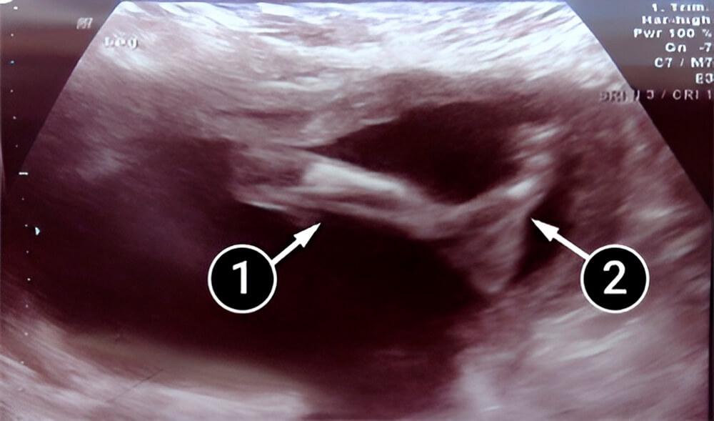 El bebé está casi listo para nacer