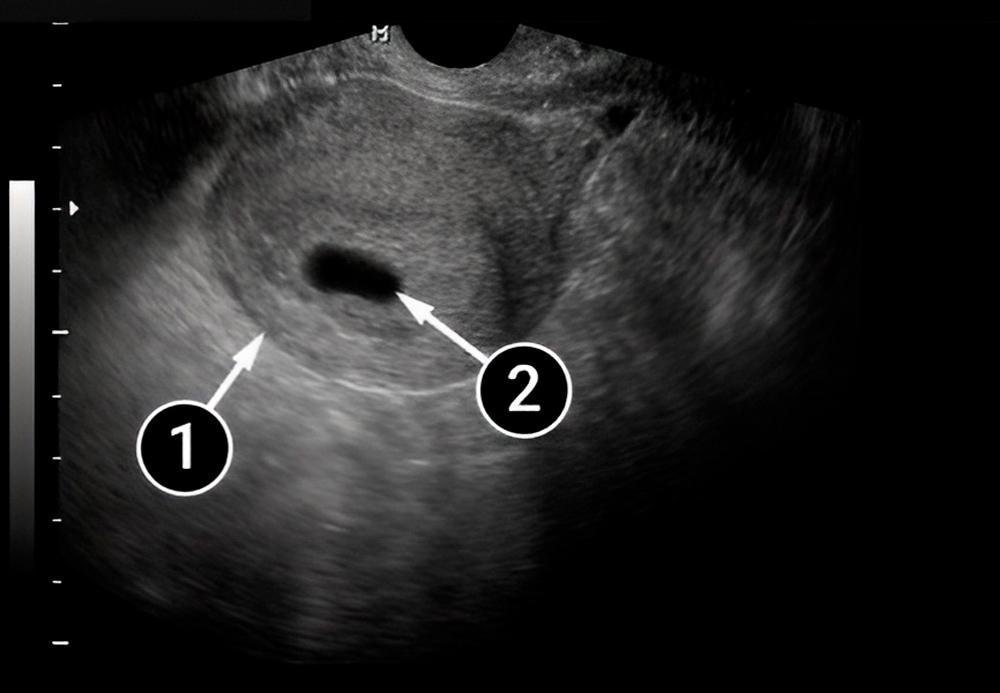 ¡El bebé está creciendo!