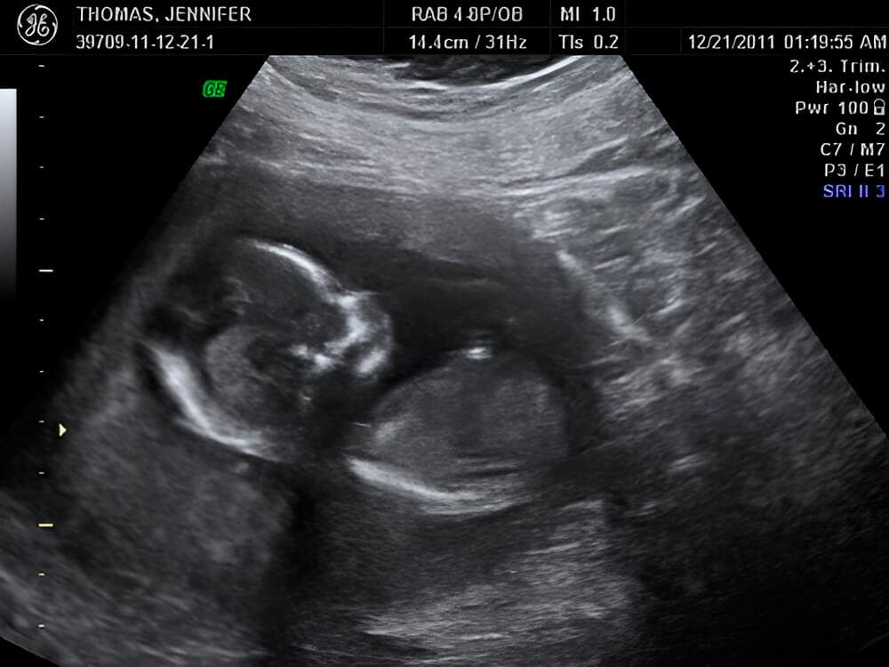 ¡Tu bebé ya puede escucharte!