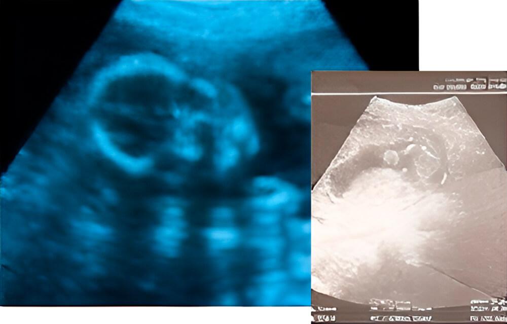 Es hora de recibir al bebé