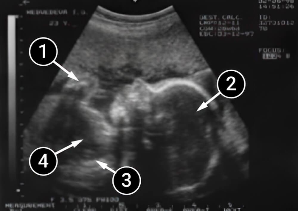 El cerebro y funciones nerviosas se están desarrollando