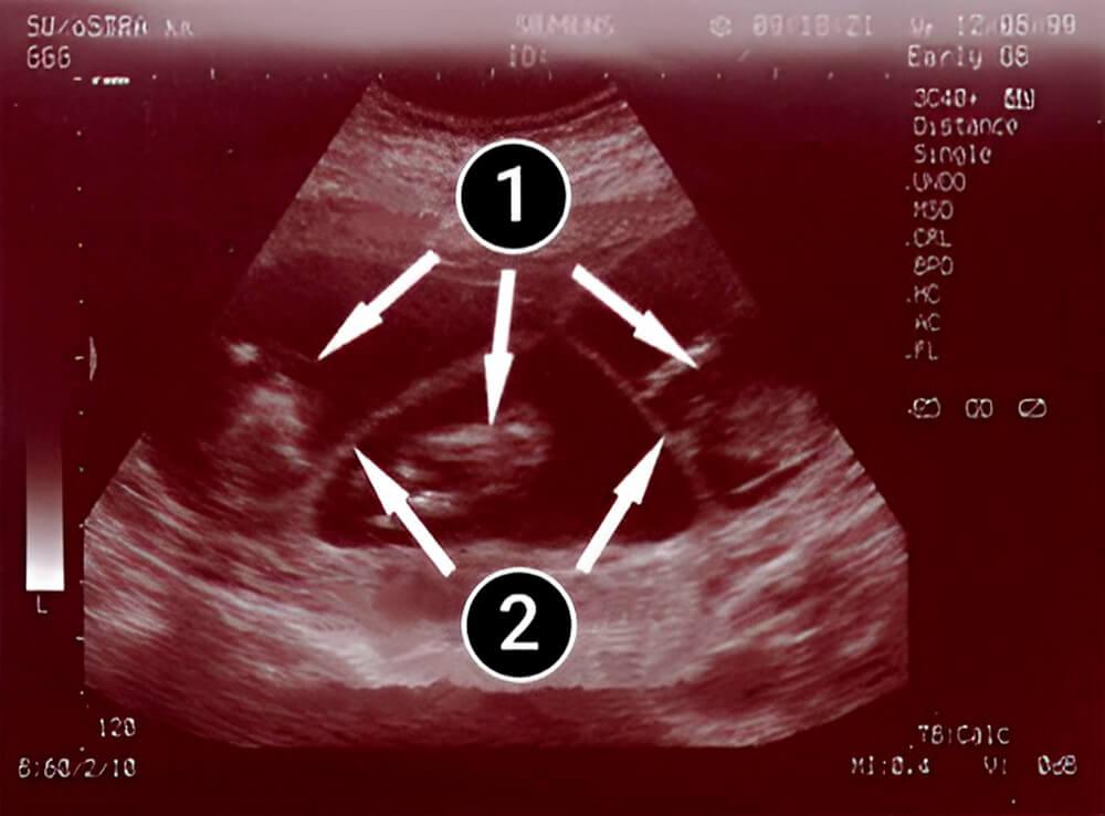 Esta semana la placenta ya está formada