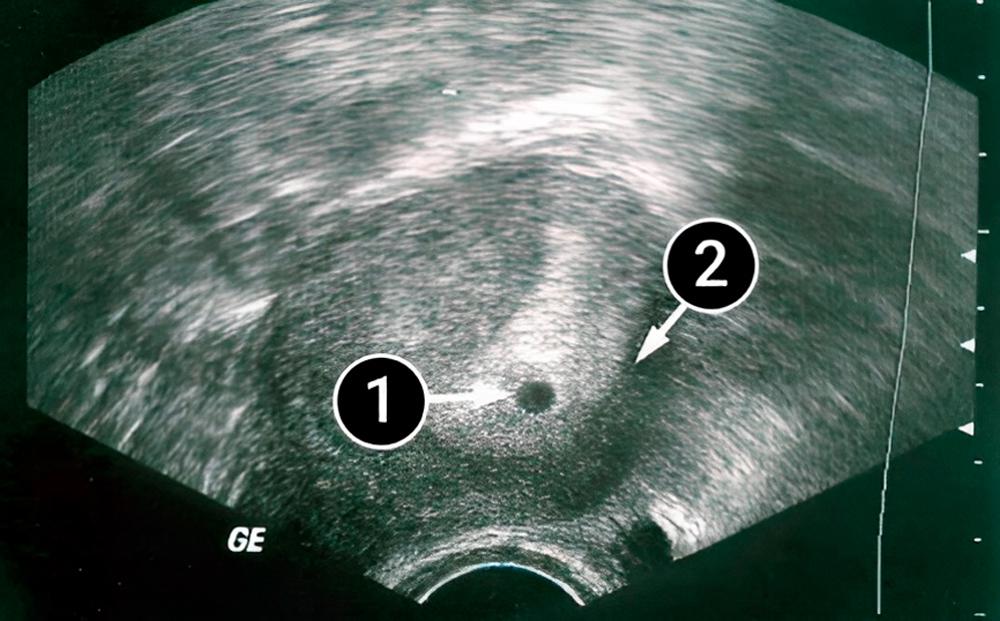 ¡Felicidades, estás embarazada!